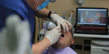 The Best Dental Implants: Restoring Smiles with Confidence